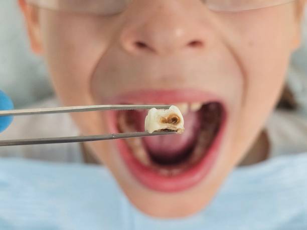 Best Emergency Dentist for Special Needs Patients in Ladoga, IN